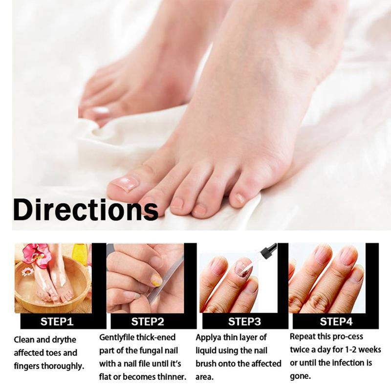 1PCS Toenail Fungus Treatment, Extra Strength Nail Fungus Remover, Toe Fingernail Repair Liquid Solution Fast Acting for Man and Woman Manicure Nailcare