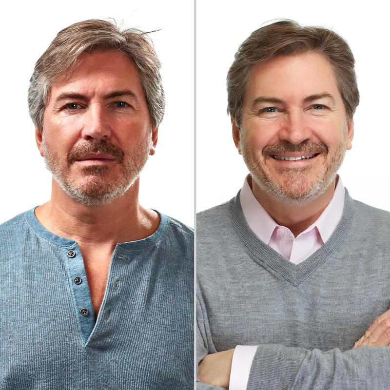 Particle Anti-Gray Serum For Men | Reverse That Gray Hair Without Harsh Chemicals