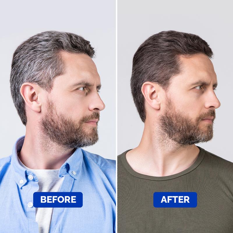 Particle Anti-Gray Serum For Men | Reverse That Gray Hair Without Harsh Chemicals