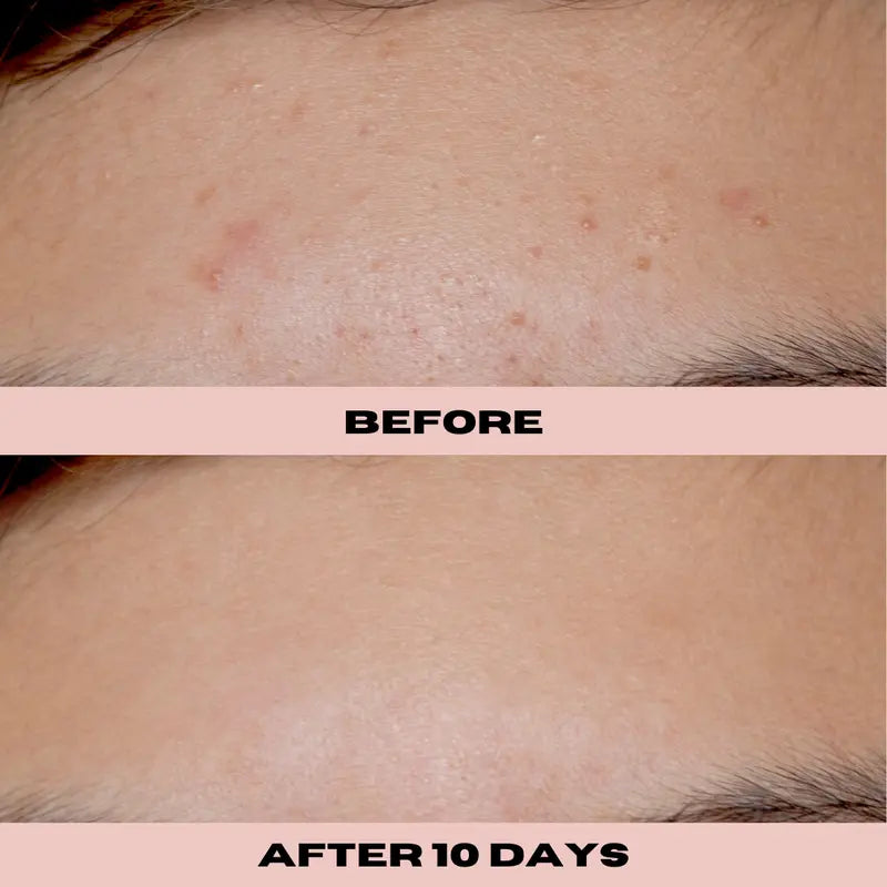 10% Glycolic Exfoliating Treatment Tonic 6 oz