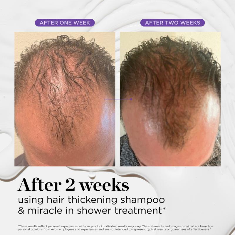 Dr. Groot Hair & Scalp Dynamic Duo Set Conditioner Haircare Keratin Shampoo for Fuller Hair, Biotin
