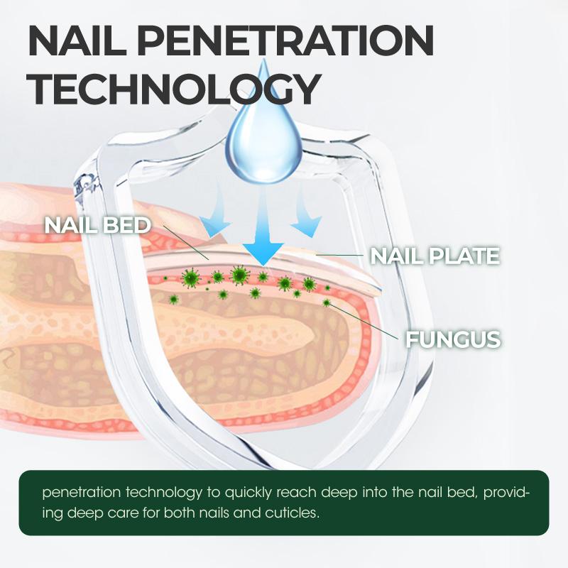 1pc【Kreain Nature】 Nail Fungus Care Formula - Multi-Purpose Nail Repair, Nail Solution for Discolored and Damaged Nails, 1.0fl oz