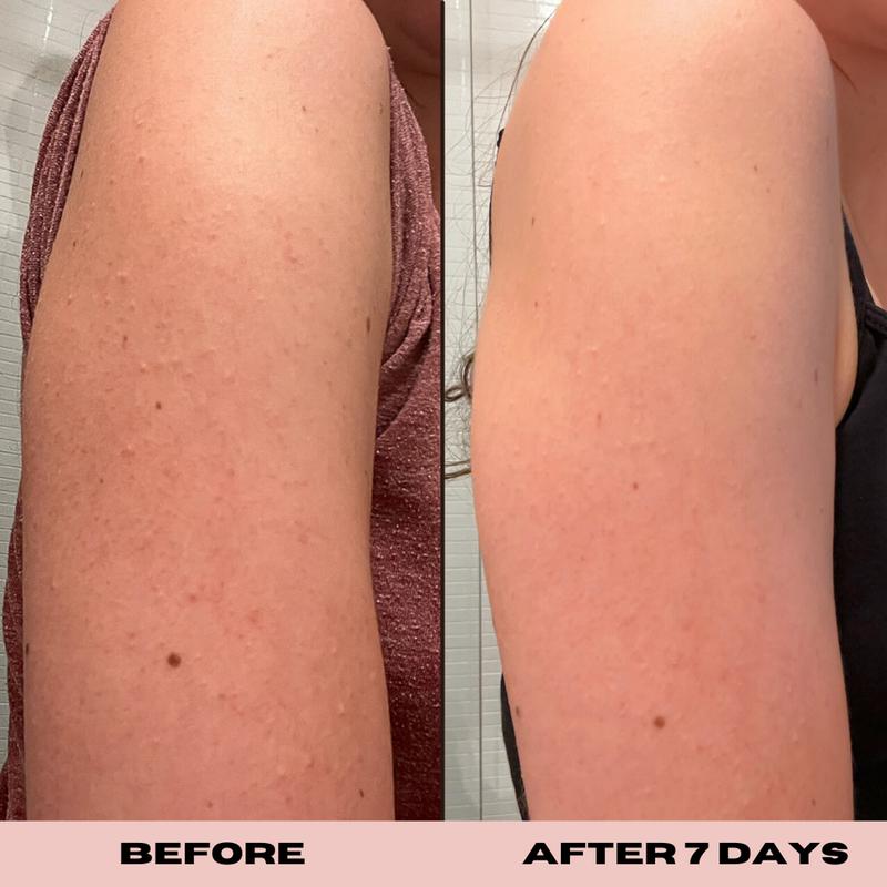 10% Glycolic Exfoliating Treatment Tonic