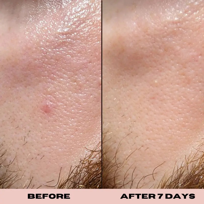 10% Glycolic Exfoliating Treatment Tonic 1 oz