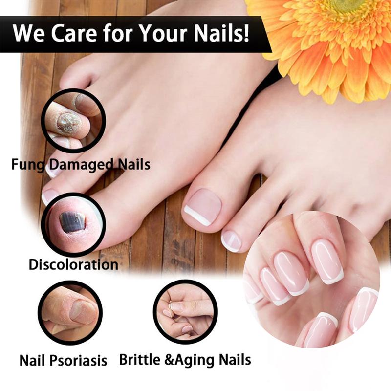 1PCS Toenail Fungus Treatment, Extra Strength Nail Fungus Remover, Toe Fingernail Repair Liquid Solution Fast Acting for Man and Woman Manicure Nailcare
