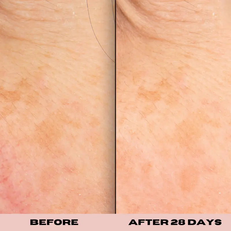 10% Glycolic Exfoliating Treatment Tonic 1 oz