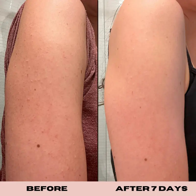10% Glycolic Exfoliating Treatment Tonic 1 oz