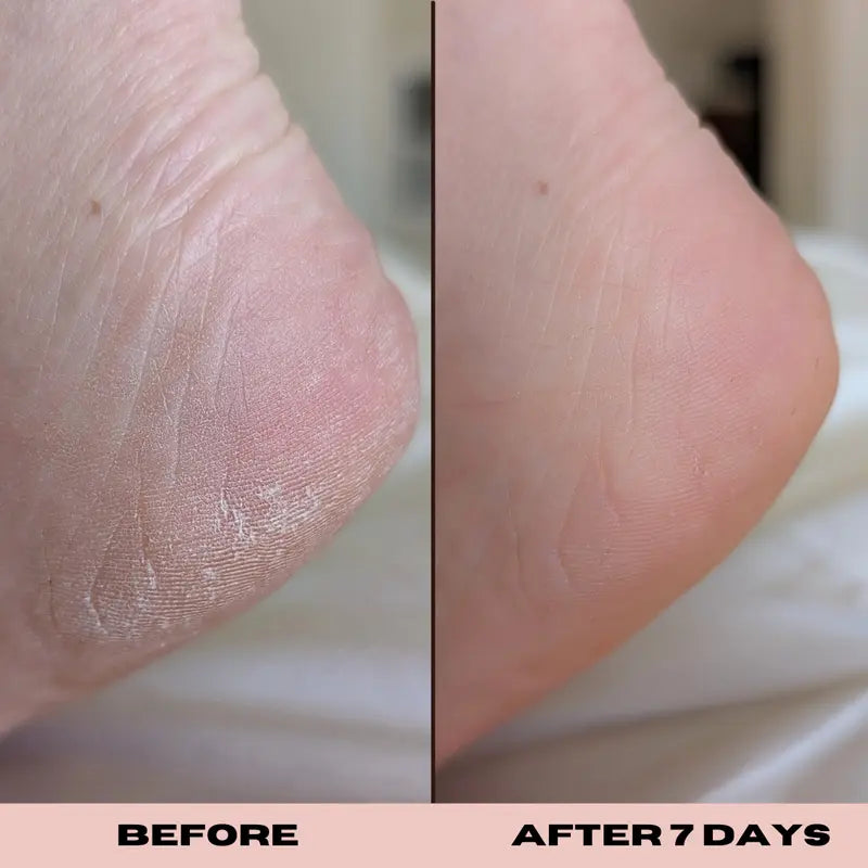 10% Glycolic Exfoliating Treatment Tonic 1 oz