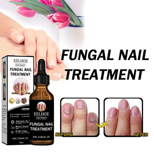 1PCS Toenail Fungus Treatment, Extra Strength Nail Fungus Remover, Toe Fingernail Repair Liquid Solution Fast Acting for Man and Woman Manicure Nailcare