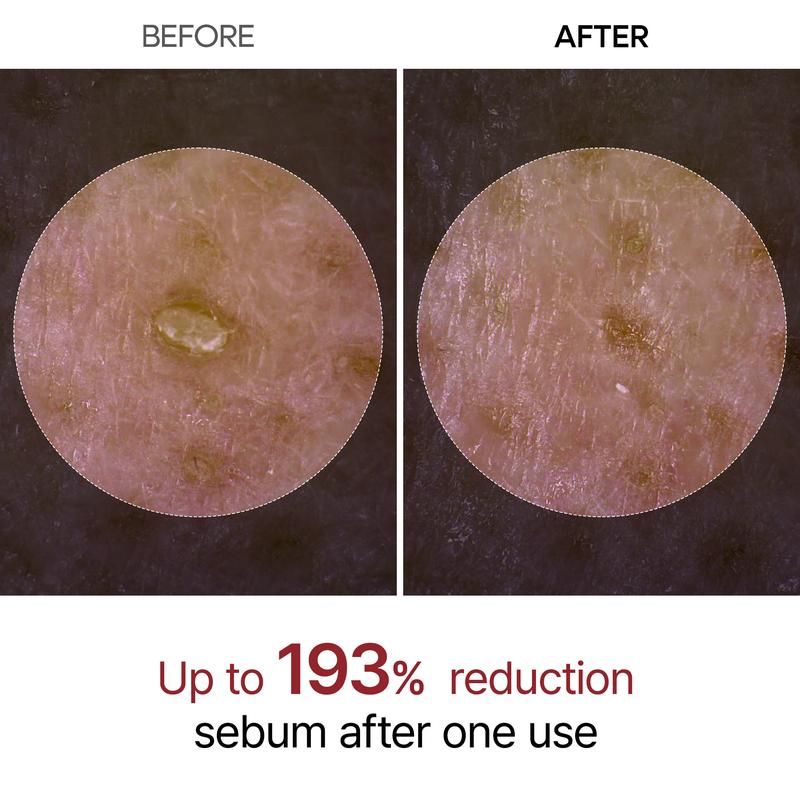 [Dr. Melaxin Official] Peel Shot Glow Rice Ampoule Duo - Serums for Brightening, Exfoliating, and Moisturizing - Suitable for All Skin Types